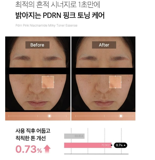 medicube PDRN Pink Niacinamide Milky Toner - Tonique unifiant