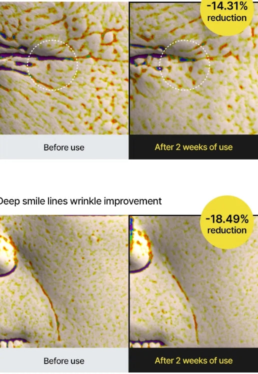 The Vita-A Retinal Shot Tightening Booster
