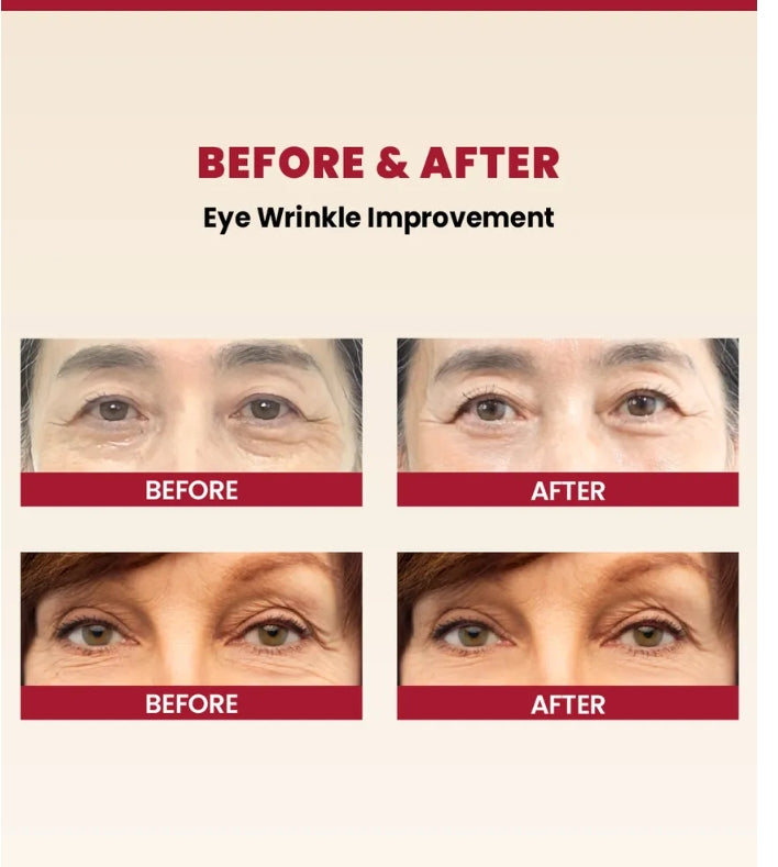 SEOUL 1988 Eye Cream : Rétinal liposome 4 % + extrait de haricot fermenté - Crème contour des yeux