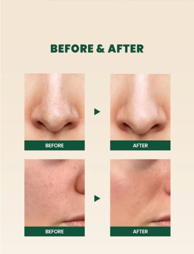 SEOUL 1988 Cleansing Foam : Pine Cica 1% + Probiotics