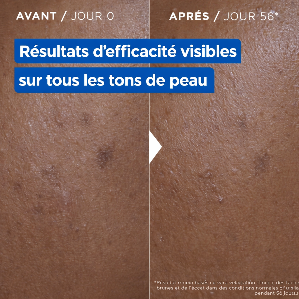Mixa NIACINAMIDE BRIGHT